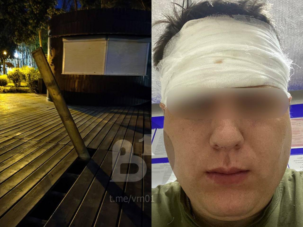 Воронежцу разбила лицо незакрепленная доска в парке «Алые паруса»