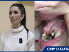 Гной и разрушение: поход в воронежскую стоматологию обернулся для девушки сущим кошмаром