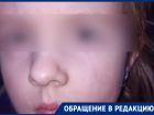 Ребёнок получил удар карандашом в глаз в воронежском детском садике