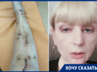 «У меня украли жизнь»: женщина-инвалид обратилась к Бастрыкину после череды операций в Воронеже 