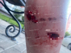 Бешеных псов, набросившихся на девушек в воронежском ЖК, не смогли отловить