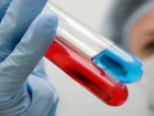 Воронежские врачи зафиксировали низкий уровень распространения ВИЧ-инфекции в регионе