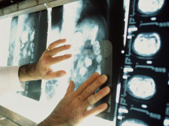 Катастрофический рост смертности от рака объяснили воронежские врачи