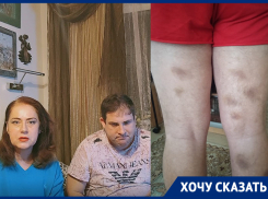 «Сына-инвалида избили до обморока подростки», – жительница Воронежа обратилась к губернатору Гусеву и начальнику полиции Бородину