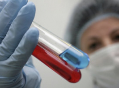Воронежские врачи готовятся к выявлению и лечению больных лихорадкой Эбола