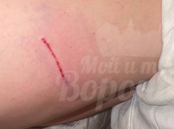 Бездомные собаки покусали женщину возле ГЧ в Воронеже