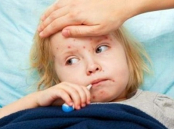 В Воронеже украинцам делают прививки от кори