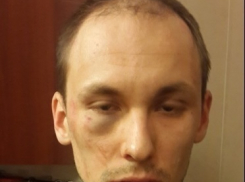 В Воронеже избит лидер местного отделения «Справедливой России» в Новоусманском районе