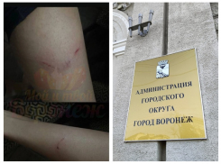 На нападение агрессивной стаи бездомных псов на женщину в центре Воронежа отреагировали чиновники