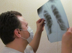 В Воронежской области все меньше умирают от туберкулеза 