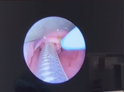 2-месячного малыша, который не мог дышать, спасли в Воронеже