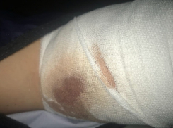 Стрельба по школьникам в день Пасхи привела к уголовному делу в Воронеже 