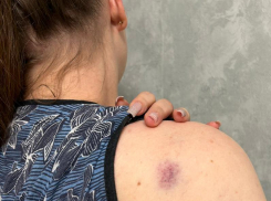 Жесткое нападение с ножом на бывшую жену проверят воронежские следователи