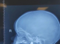 1,5-годовалая малышка едва не задохнулась из-за магнита в Воронеже