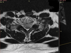 Первую нейрохирургическую операцию провели в Воронеже