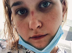 Люди умирают: студентка из ковидного отделения эмоционально обратилась к жителям Воронежа