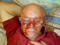 76-летнего инвалида варварски избил односельчанин в Воронежской области