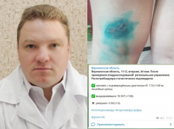 Коронавирус в Воронеже 4 мая: +150 зараженных, 5 смертей и укус бездомной собаки 