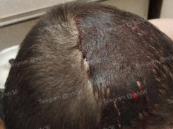 Школьники разбили голову прохожему в Воронеже