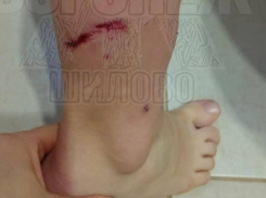 Покусавшая детей овчарка могла прийти с частного сектора в Воронеже