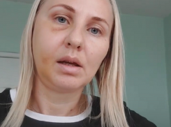 Полиция прокомментировала «ужасное событие» с переломом черепа на воронежском катке 