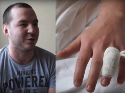 Активисту «Единой России» сделали прививку от укуса воронежских сторонников Навального