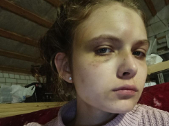 СК возбудил дело после публикации «Блокнот Воронеж» об избиении и изнасиловании девушки     