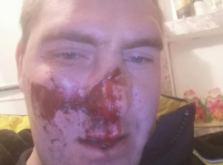 Жительница Воронежской области рассказала, что её сына избили понятые под молчаливое одобрение полицейских