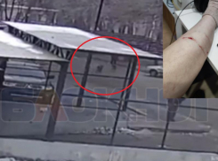 Нападение стаи собак на девушку попало на видео в Воронеже 