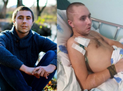 22-летнему воронежцу, пострадавшему в страшной аварии с катерами, потребуется 2,5 млн на спасение жизни