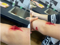 Бастрыкин заинтересовался нападением ротвейлера на ребенка в Воронеже