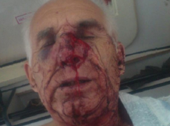 В Воронеже жестоко избили гражданского активиста