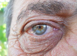 28-летний воронежец жестоко избил родного деда за нравоучения