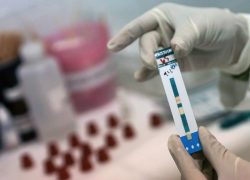 Около сотни воронежцев проверили врачи на наличие СПИДа