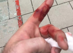 Выпавшее из холодильника с пивом стекло довело воронежских посетителей «Пятерочки» до кровавых травм