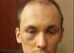 В Воронеже избит лидер местного отделения "Справедливой России" в Новоусманском районе