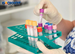 Бруцеллез у животных выявили в 700 метрах от жилого дома в воронежском селе