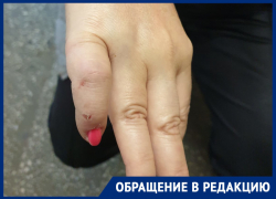 Жительница Воронежа попала в яму-ловушку и сломала палец 