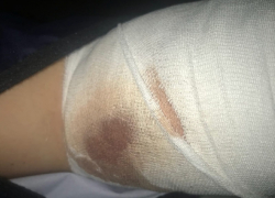 Стрельба по школьникам в день Пасхи привела к уголовному делу в Воронеже 