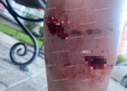 Бешеных псов, набросившихся на девушек в воронежском ЖК, не смогли отловить
