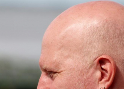 Мужчина проломил череп своему приятелю в Коминтерновском районе Воронежа 