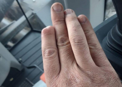 «ЭкоНивой» Штефана Дюрра заинтересовались следователи после истории с отрубленным пальцем