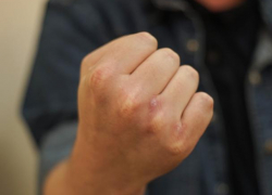 Воронежец отделался исправительными работами за метание ножа в детей