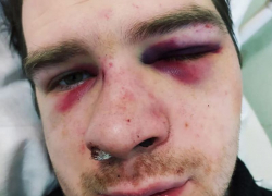 Под Воронежем молодого отца зверски избили на глазах у его детей