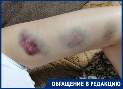  Мать двоих детей получила синяки после встречи с полицейским в Воронежской области 