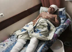 Крупного воронежского бизнесмена исполосовали ножом в торговом центре 