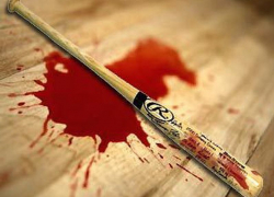 Воронежца жестко избили бейсбольной битой в ночном клубе