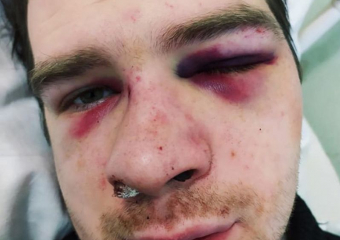 Под Воронежем молодого отца зверски избили на глазах у его детей