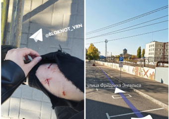 Огромная собака накинулась на девушку в центре Воронежа – опубликованы кадры последствий