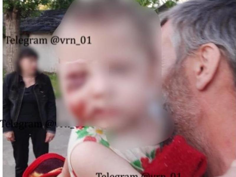 Мать избитой малышки оштрафовали в Воронеже